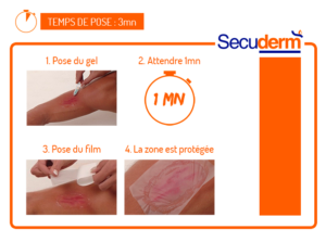 pose protection etanche secuderm