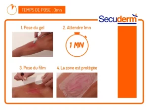 pose protection etanche secuderm