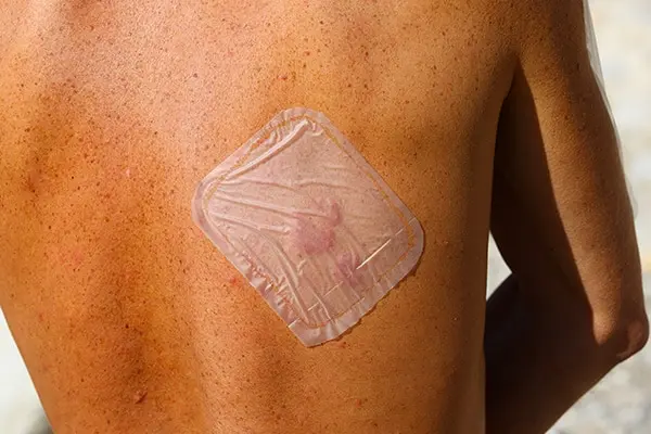 protection_pansement_etanche_dermatite
