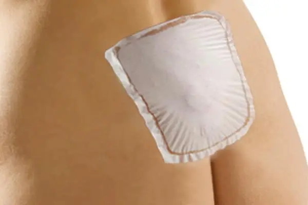 protection_pansement_etanche_kyste_pilonidal
